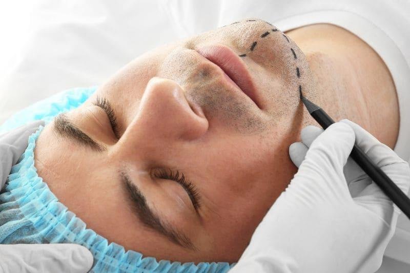 Men-look-more-attractive-trustworthy-after-plastic-surgery-study-shows
