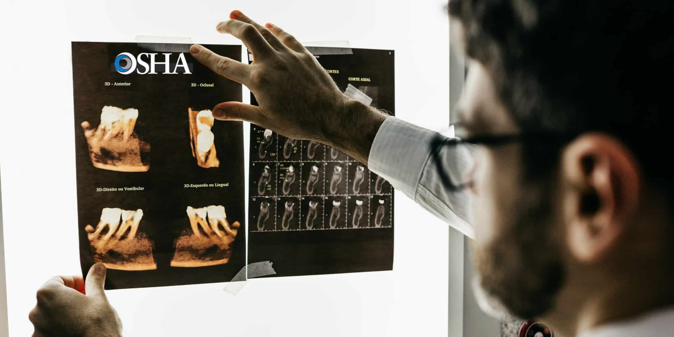 OSHA-Regulations-for-Dental-X-rays