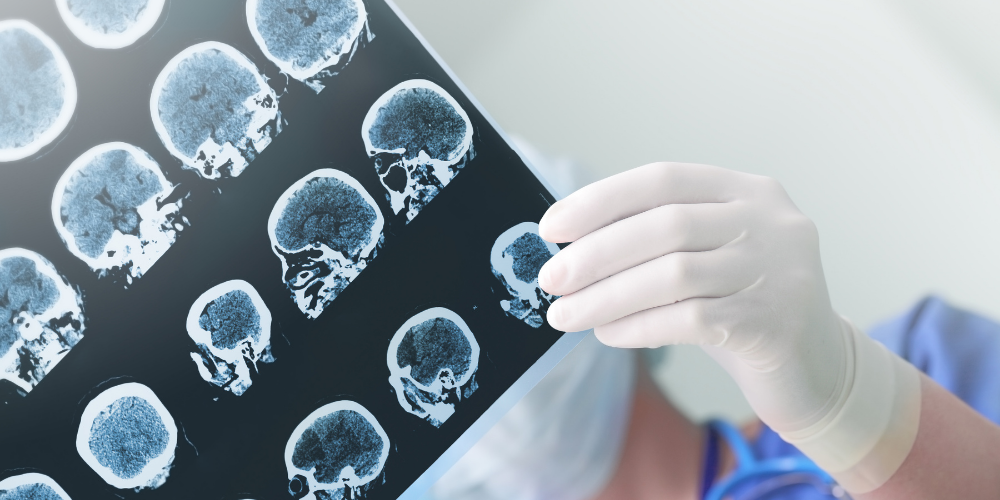 Why-should-you-instruct-a-medical-expert-witness