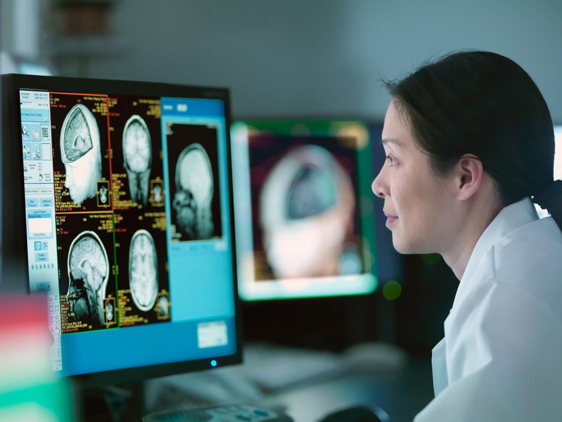 a-neurologist-looking-at-a-brain-scan